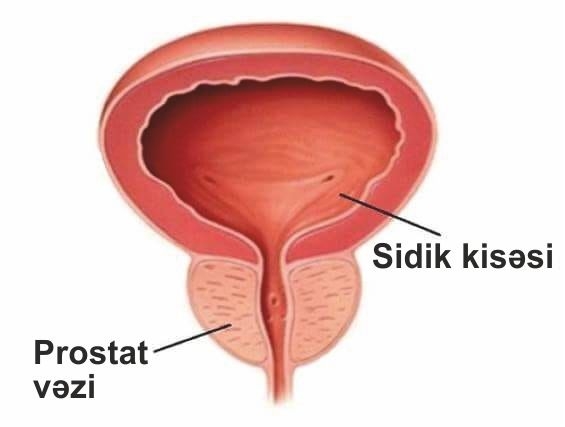 Prostat vəzi. Prostat vəzinin xəstəlikləri